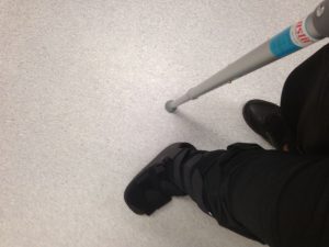 Me in my Moon Boots during the recovery phase